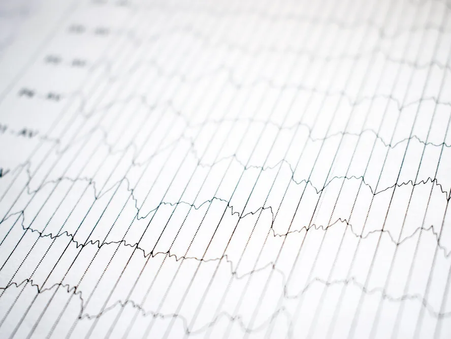 EEG-1
